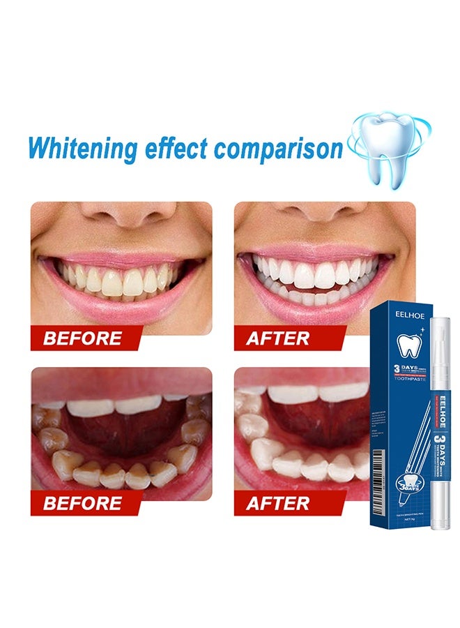 EELHOE Teeth Whitening Pen, Tooth Whitening Pen for Bright White Teeth, Teeth Whitening Gel for Oral Care, Fast Removes Years of Stains - Image 4